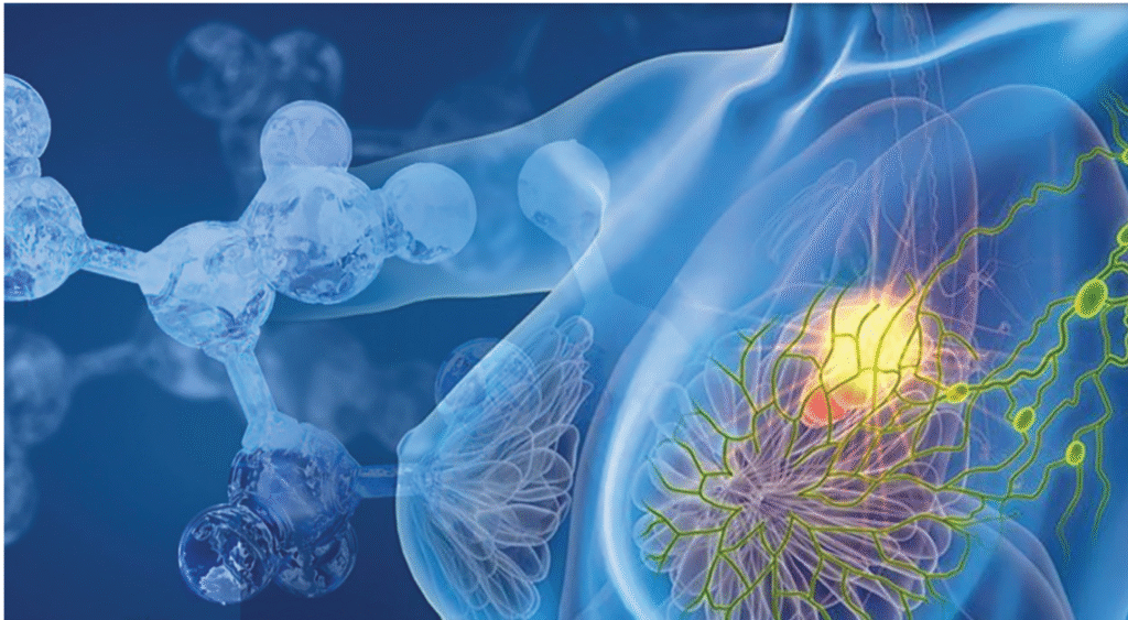Сентинелна лимфна биопсия при рак на гърдата tumor biology