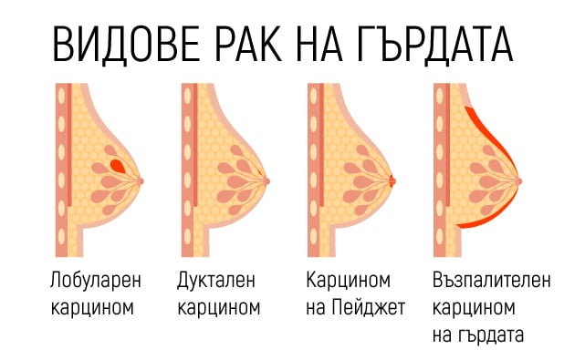 vidove rak gyrda