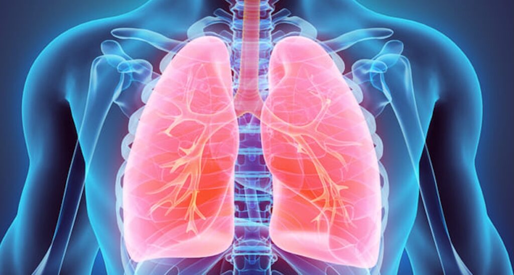 lung cancer treatment istanbul